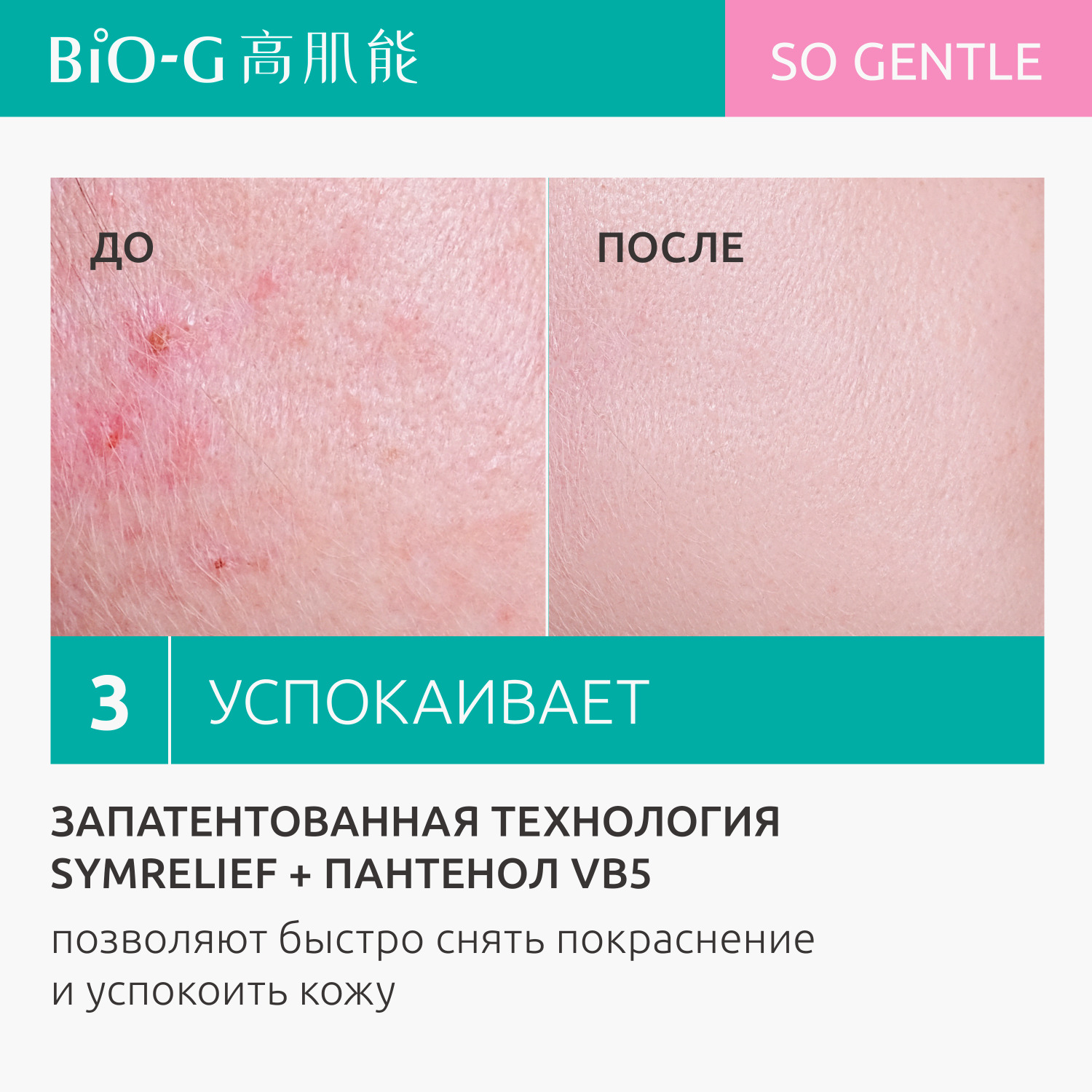 Средство для умывания и очищения Bio-G GENTLE для чувствительной кожи увлажняющее 100 мл - фото 5