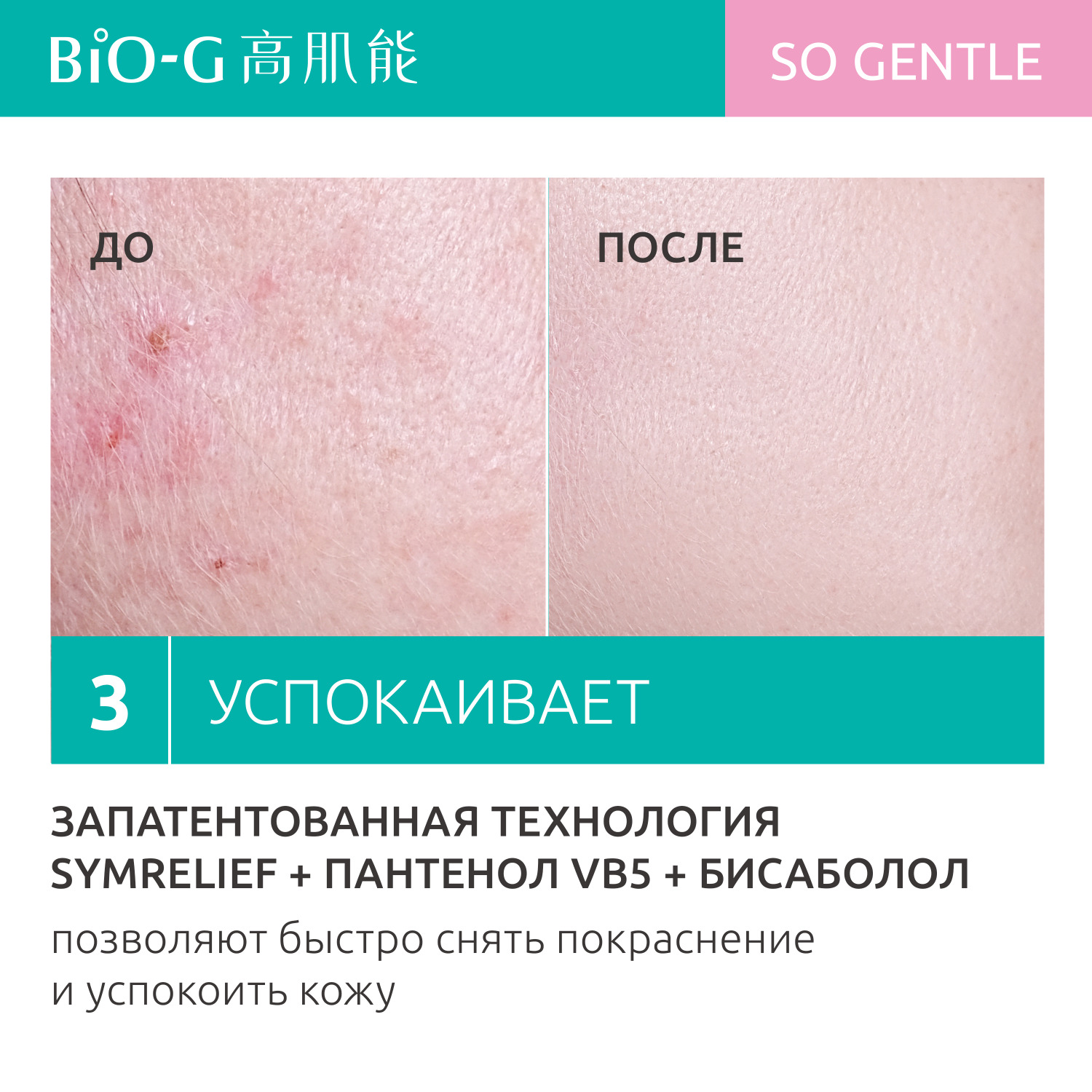 Увлажняющий тонер Bio-G GENTLE для чувствительной кожи лица восстанавливающий, 120 мл - фото 5